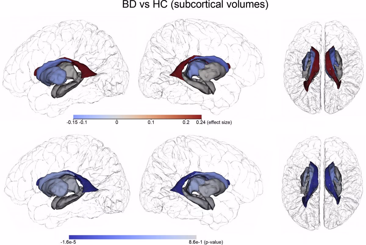 ¿Qué estudio determina la bipolaridad?