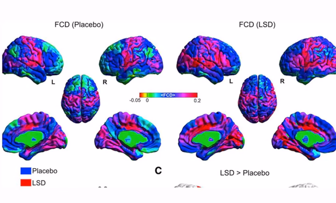¿Cuál es el uso del LSD en psiquiatría?
