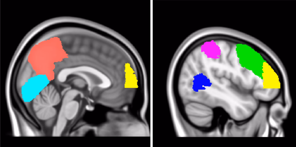 What is the science behind lucid dreaming?