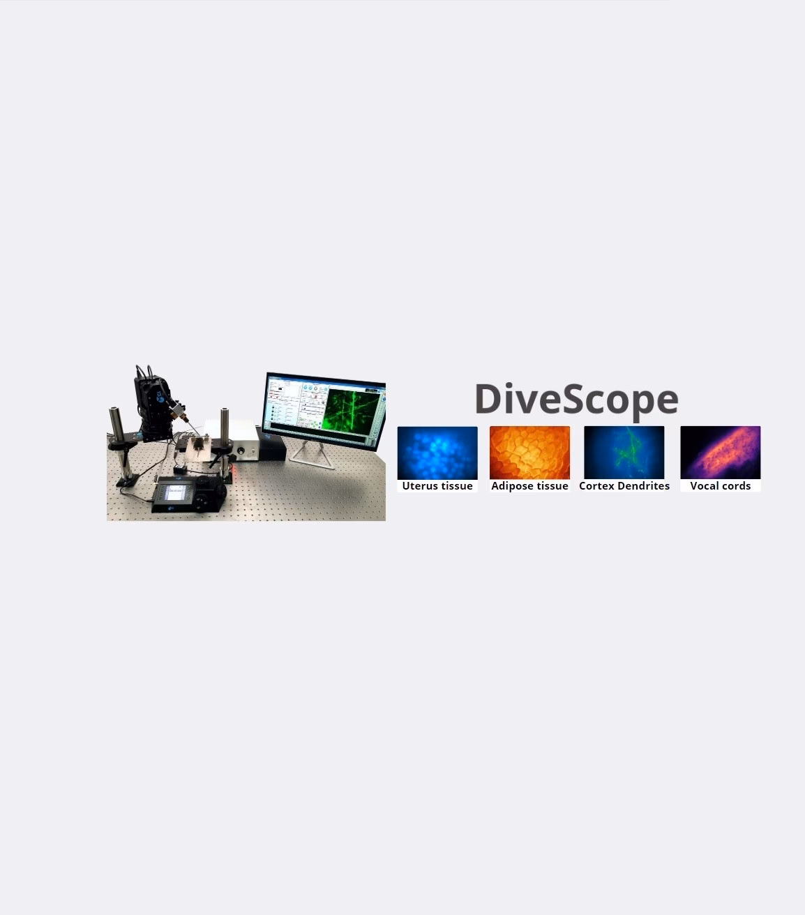 What is MCI in neuroscience?