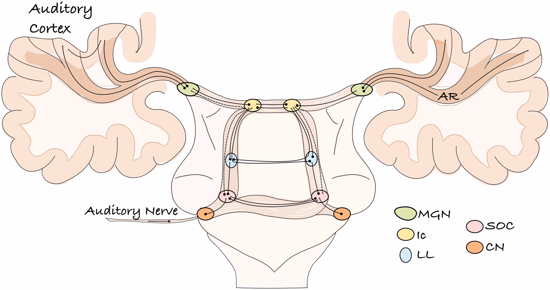 What is the function of the MGN in the brain?