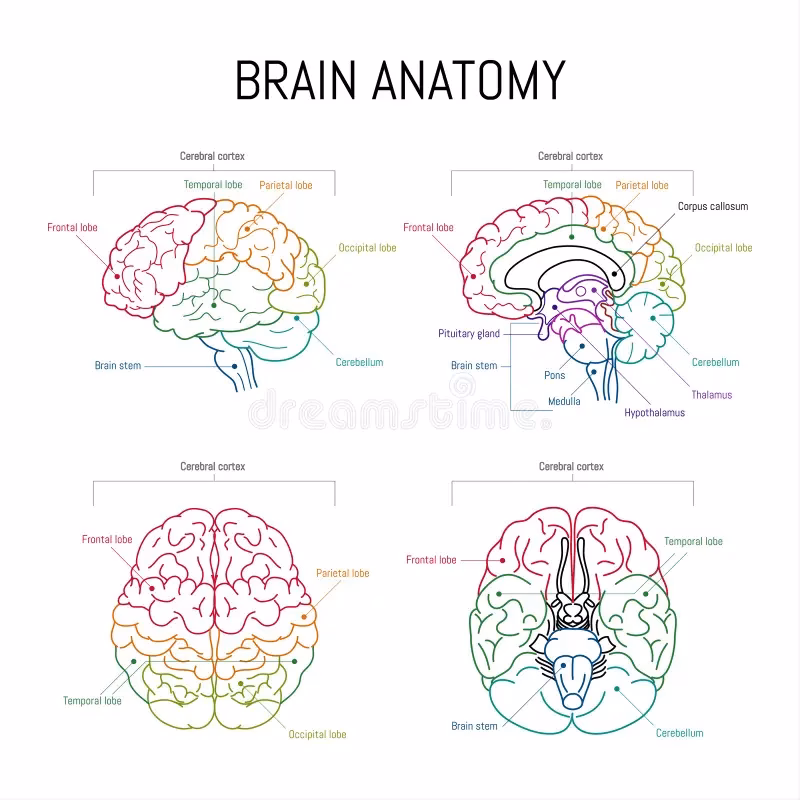 ¿Qué significa tener el cerebro blanco?