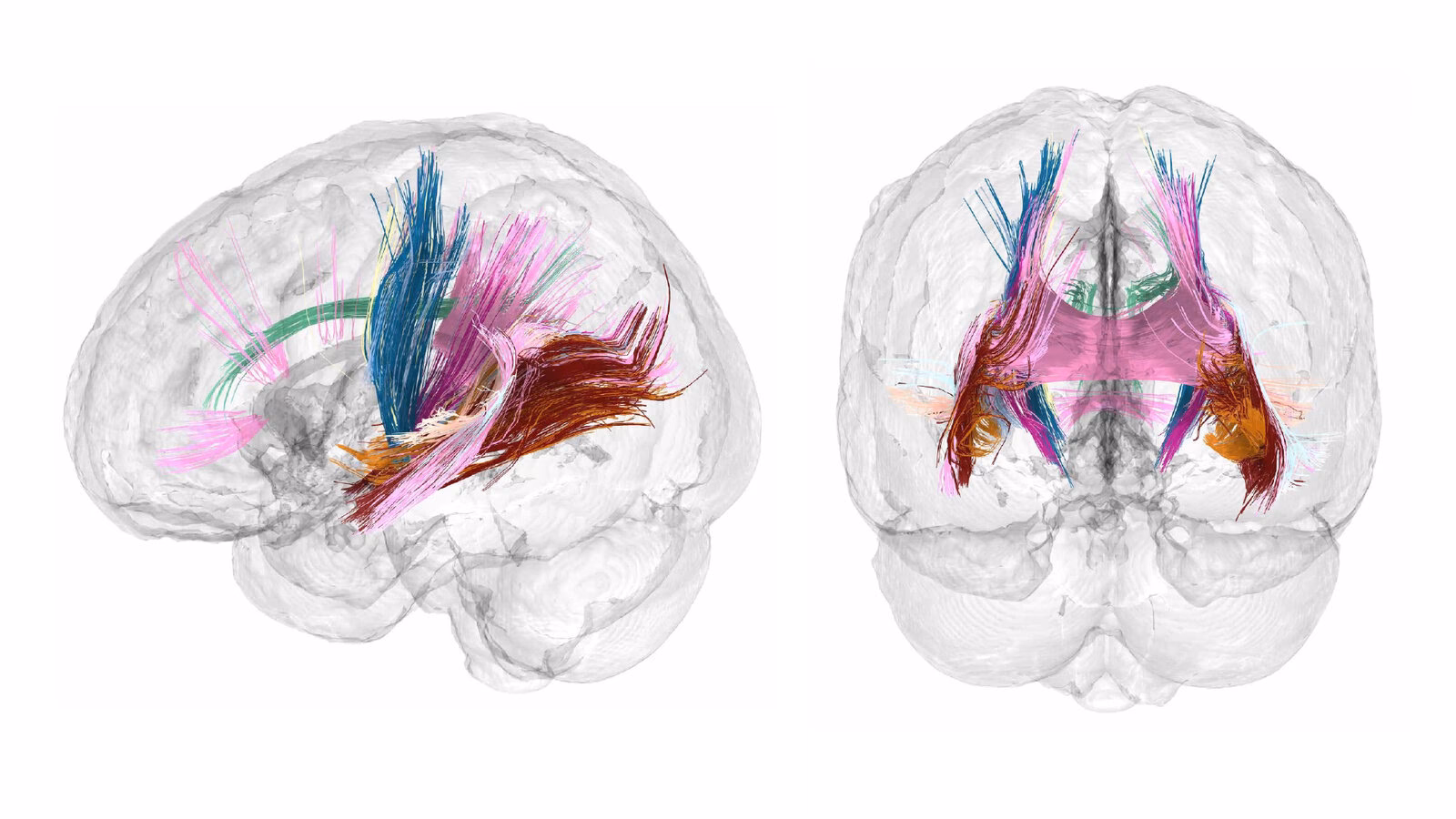 ¿Cuánto tiempo dura el mommy brain?