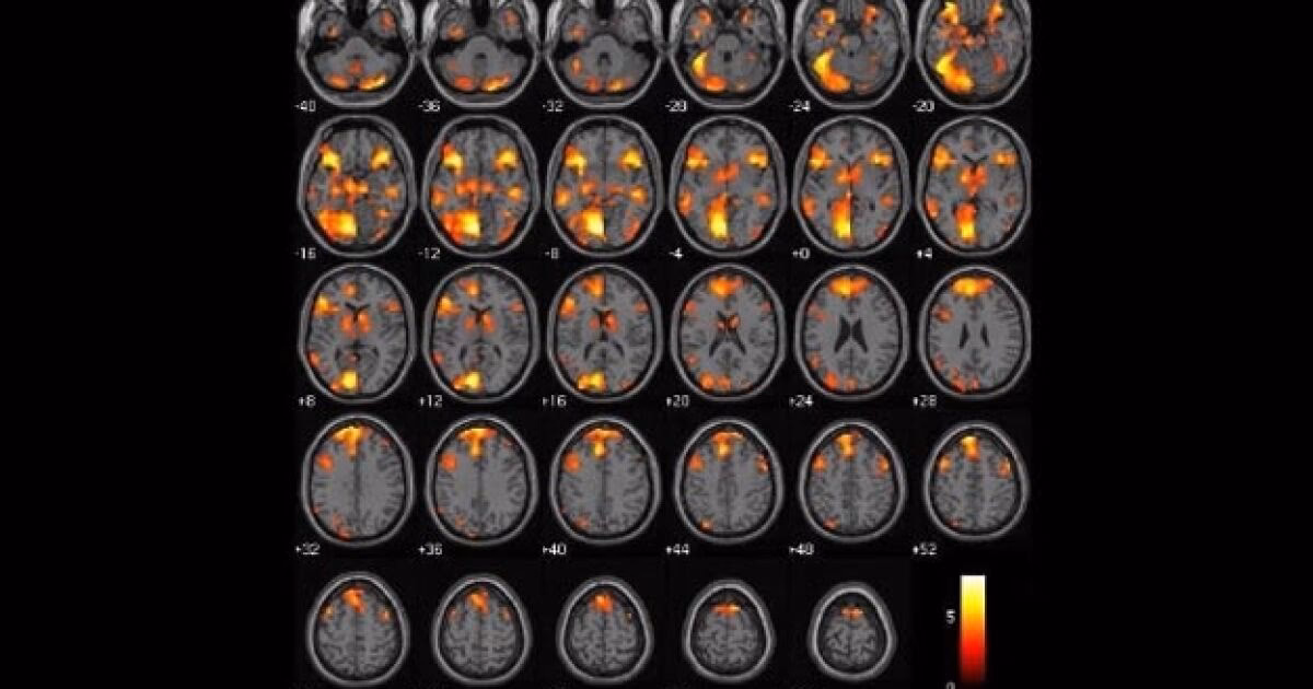 ¿Qué tipo de inteligencia tienen los psicópatas?