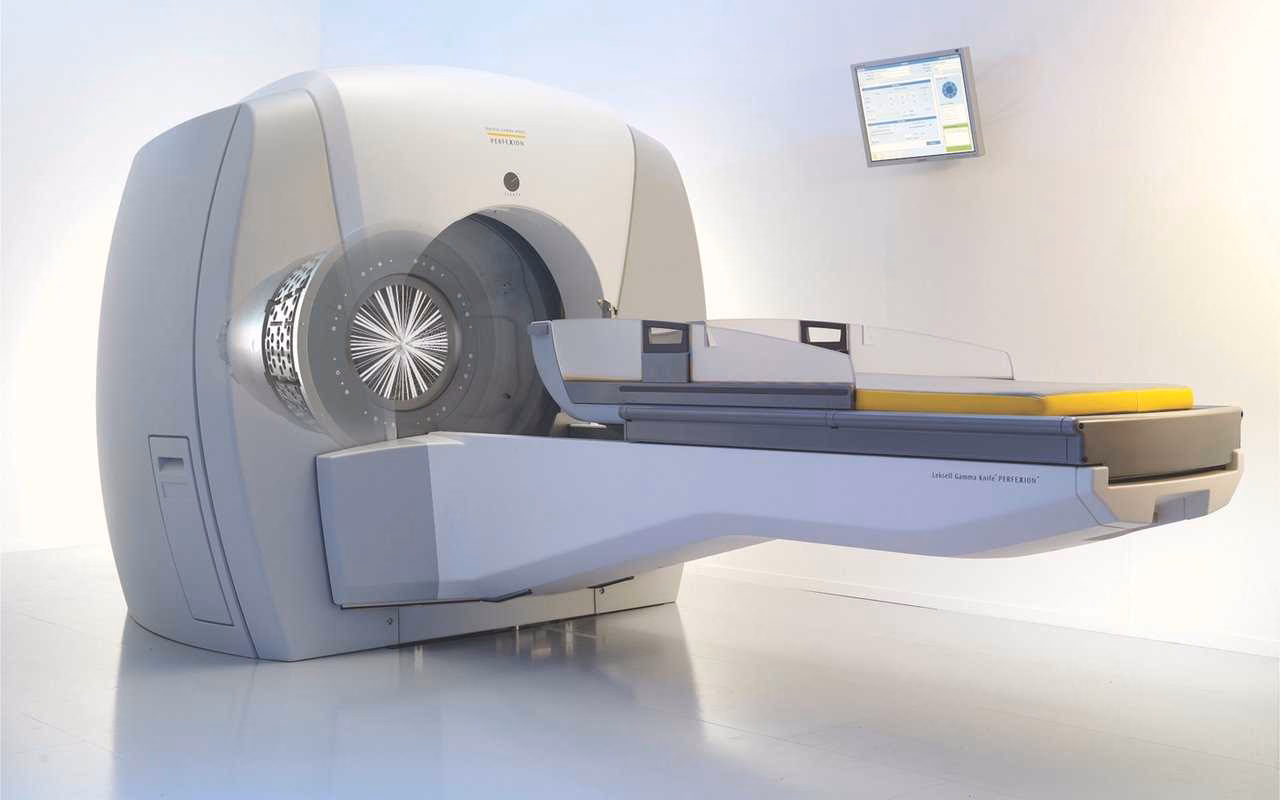 What is the life expectancy after Gamma Knife surgery for the brain?