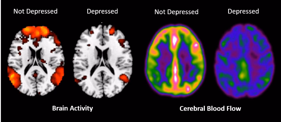 What part of the brain deals with mental illness?
