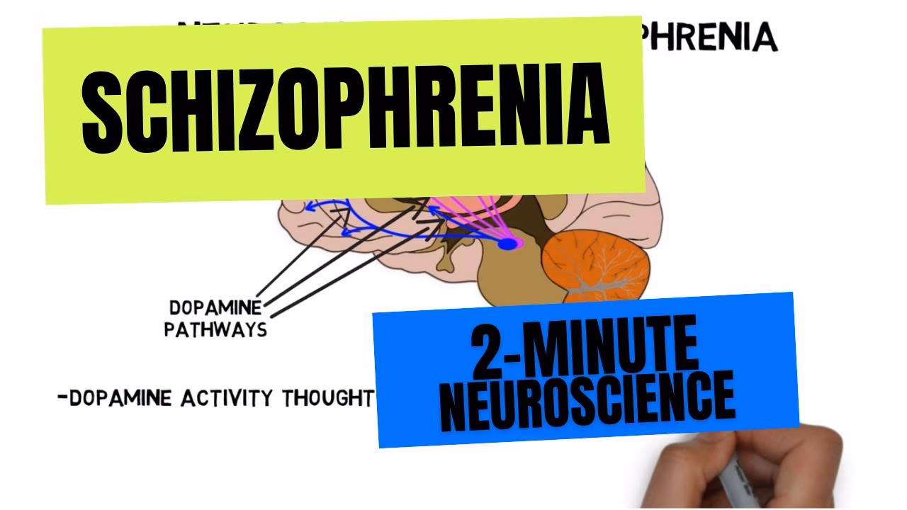 What are the neuroanatomical changes in schizophrenia?