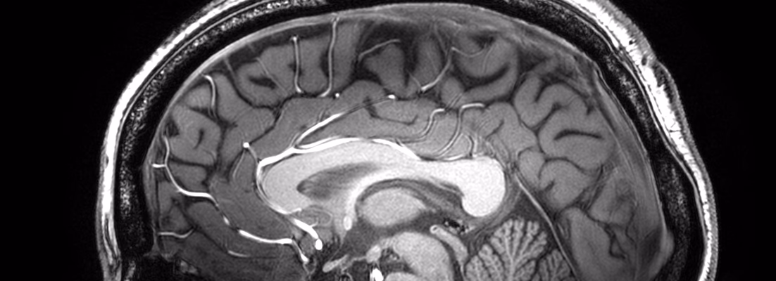 What is the acceptance rate for Nottingham neuroscience?