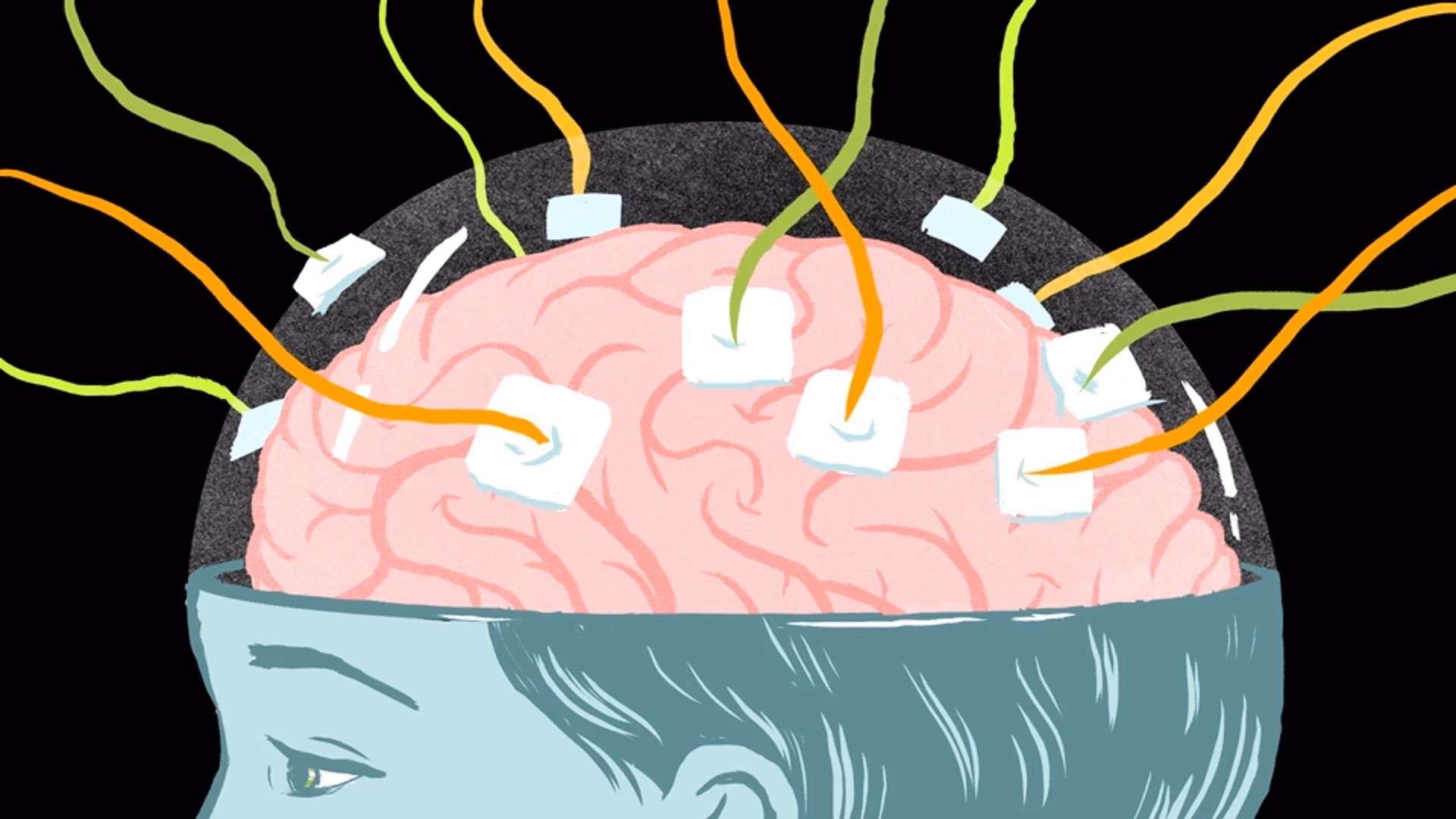 What is the famous split brain experiment?