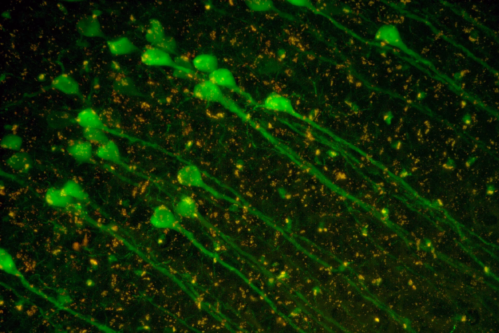 What are the three types of microscopy?