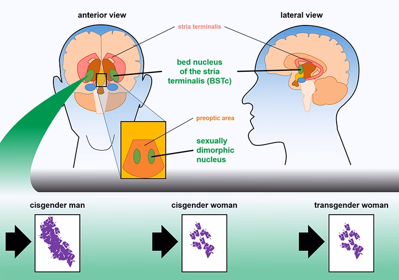 What is the root of gender dysphoria?