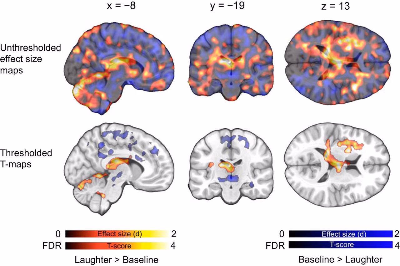 What does the brain do when you laugh?