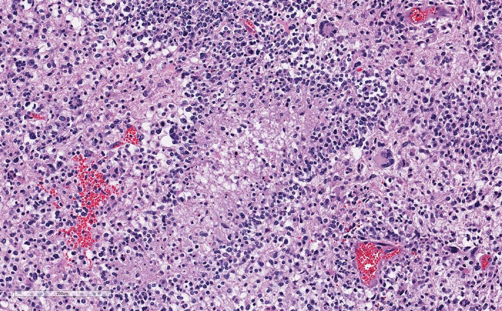 What does a neuro pathologist do?