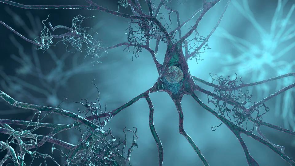 What does a neuro pathologist do?