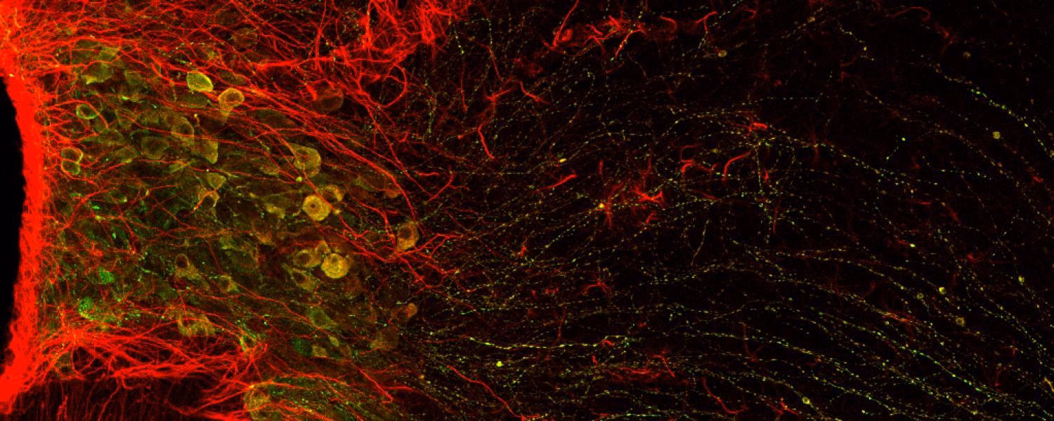 Can international students get a PhD in Canada?