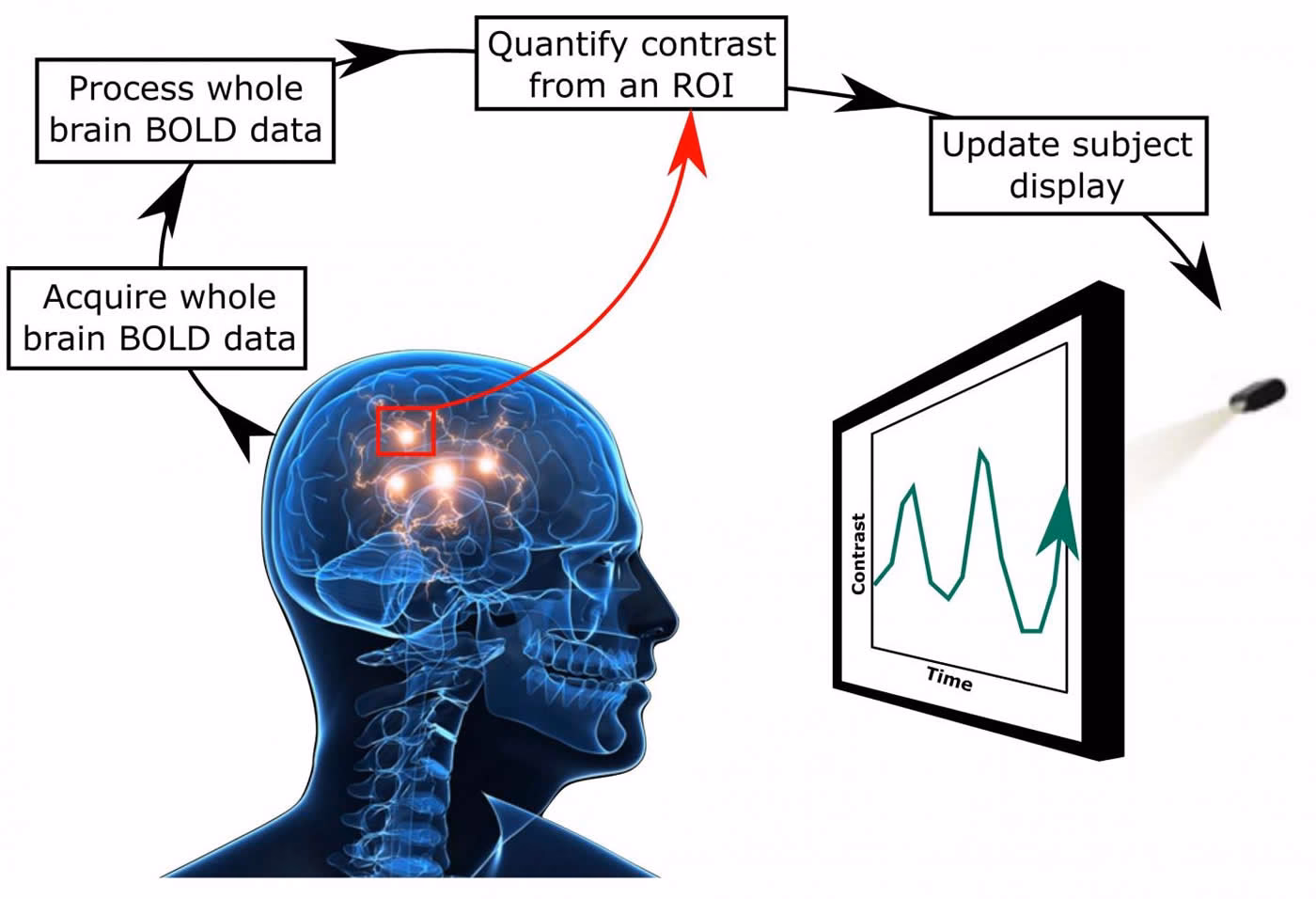What is the new hope for tinnitus sufferers?