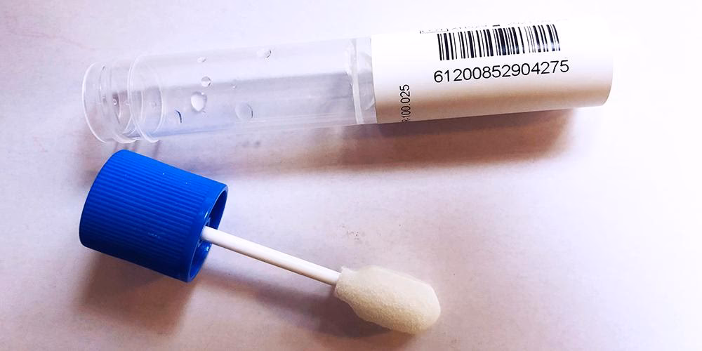 What does an adrenal saliva test tell you?