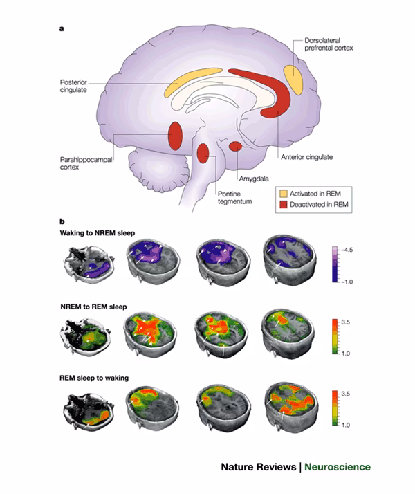 Does neurology do sleep studies?