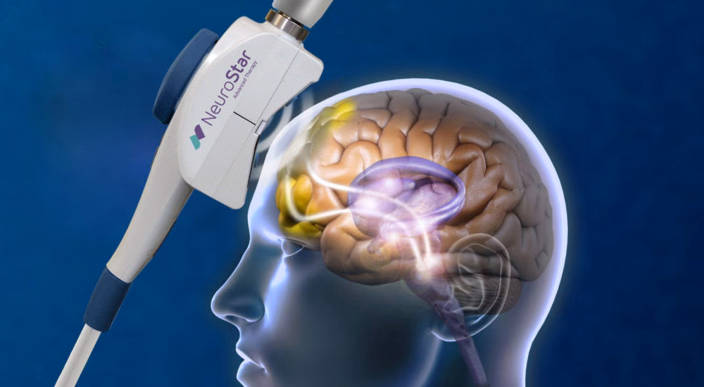 What is TMS in neuroscience?