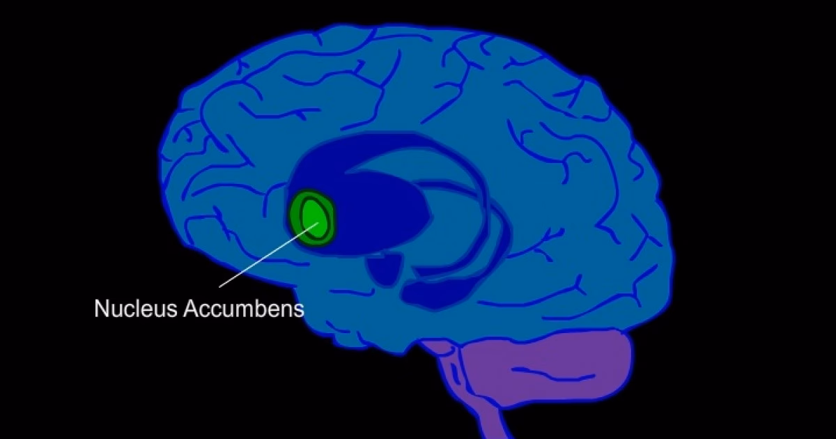 ¿Qué pasa si se daña el núcleo accumbens?