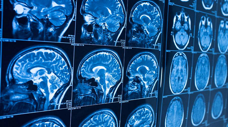 How much does Penn LPS cost?