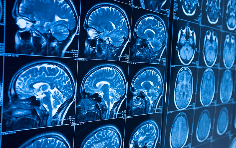 What is pharmacology in neuroscience?