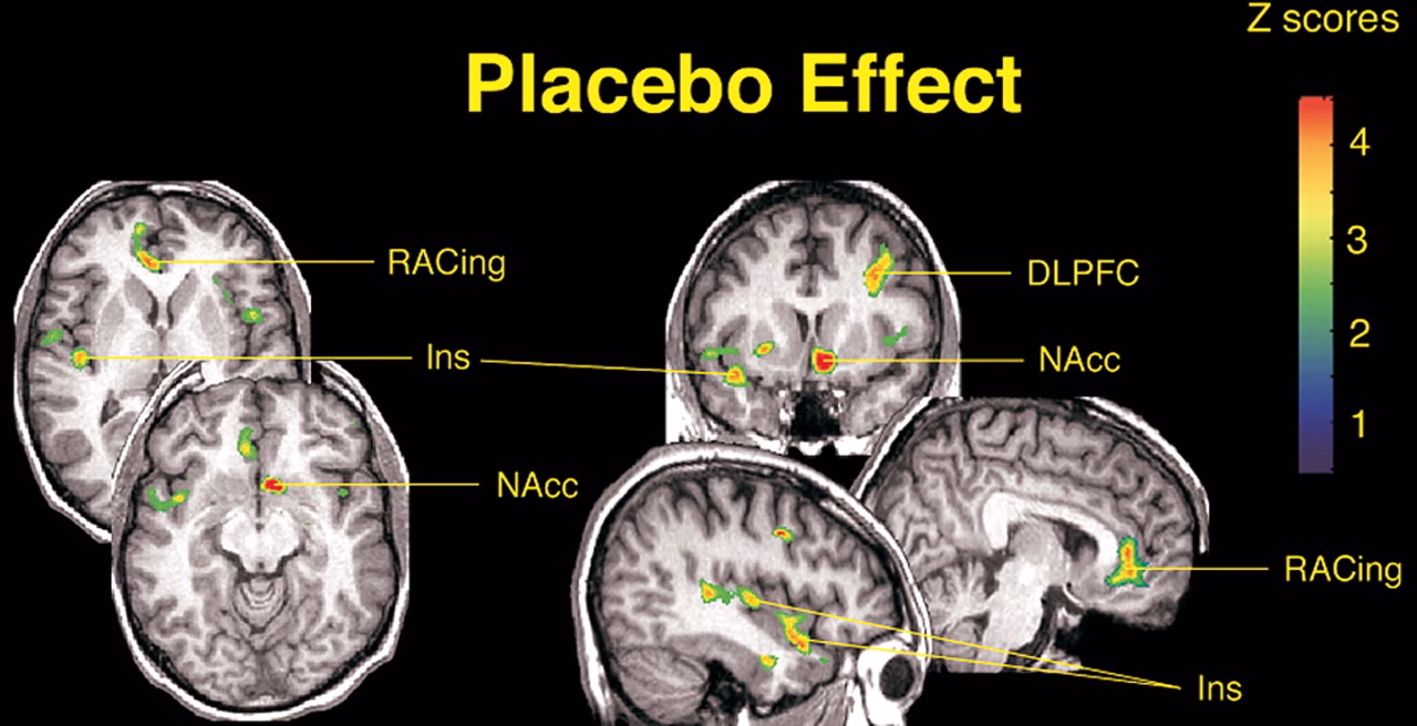What is the mechanism behind the placebo effect?