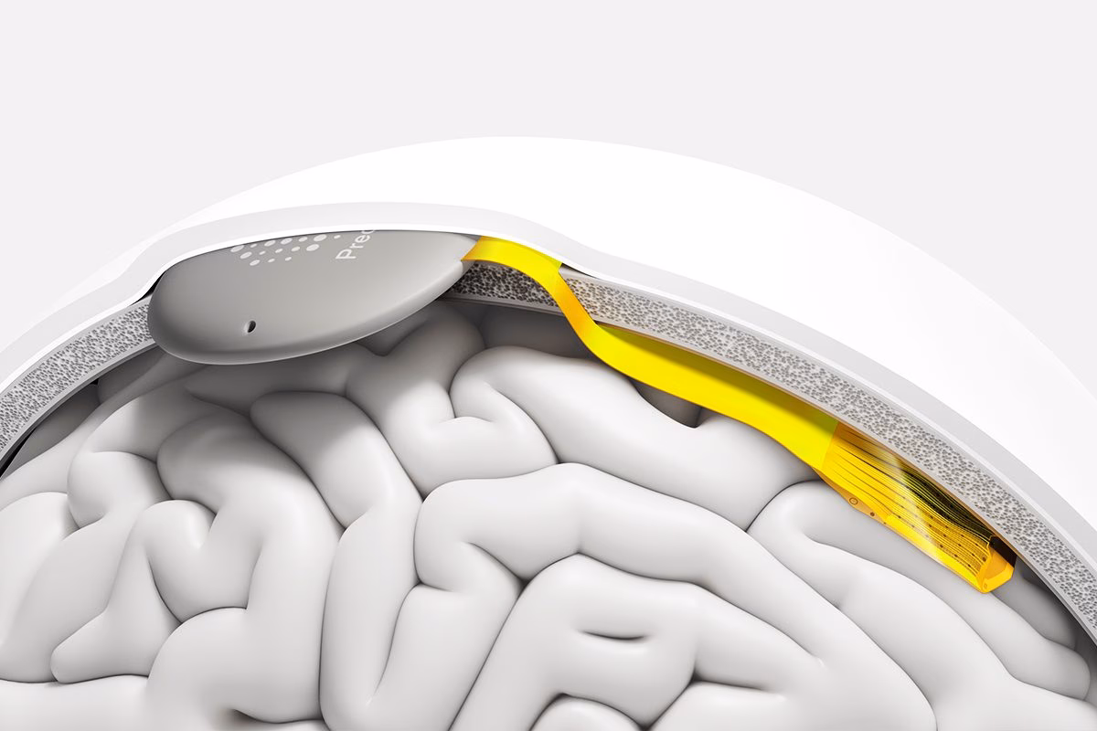 How do I contact Precision Neuroscience?