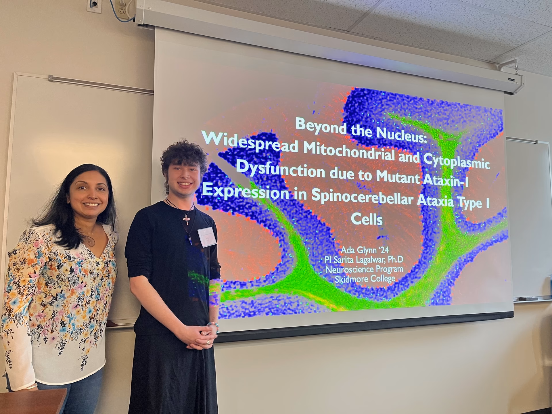 How do you qualify for Skidmore neuroscience major?