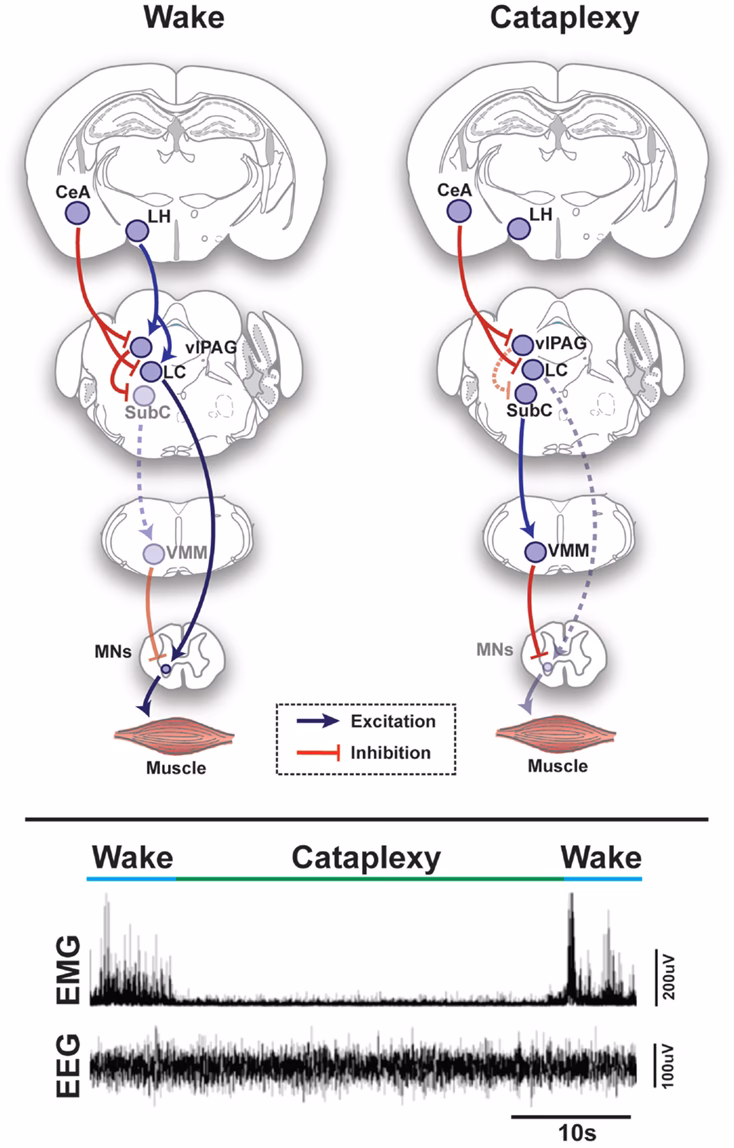 What is happening in the brain during sleep paralysis?