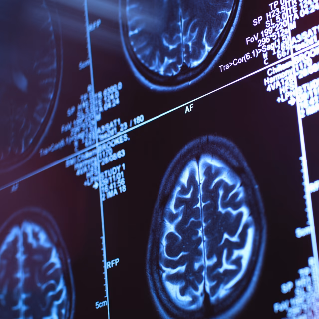 What are the top 5 majors at TCU?