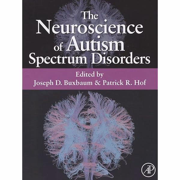 What are the cognitive abilities of autism?