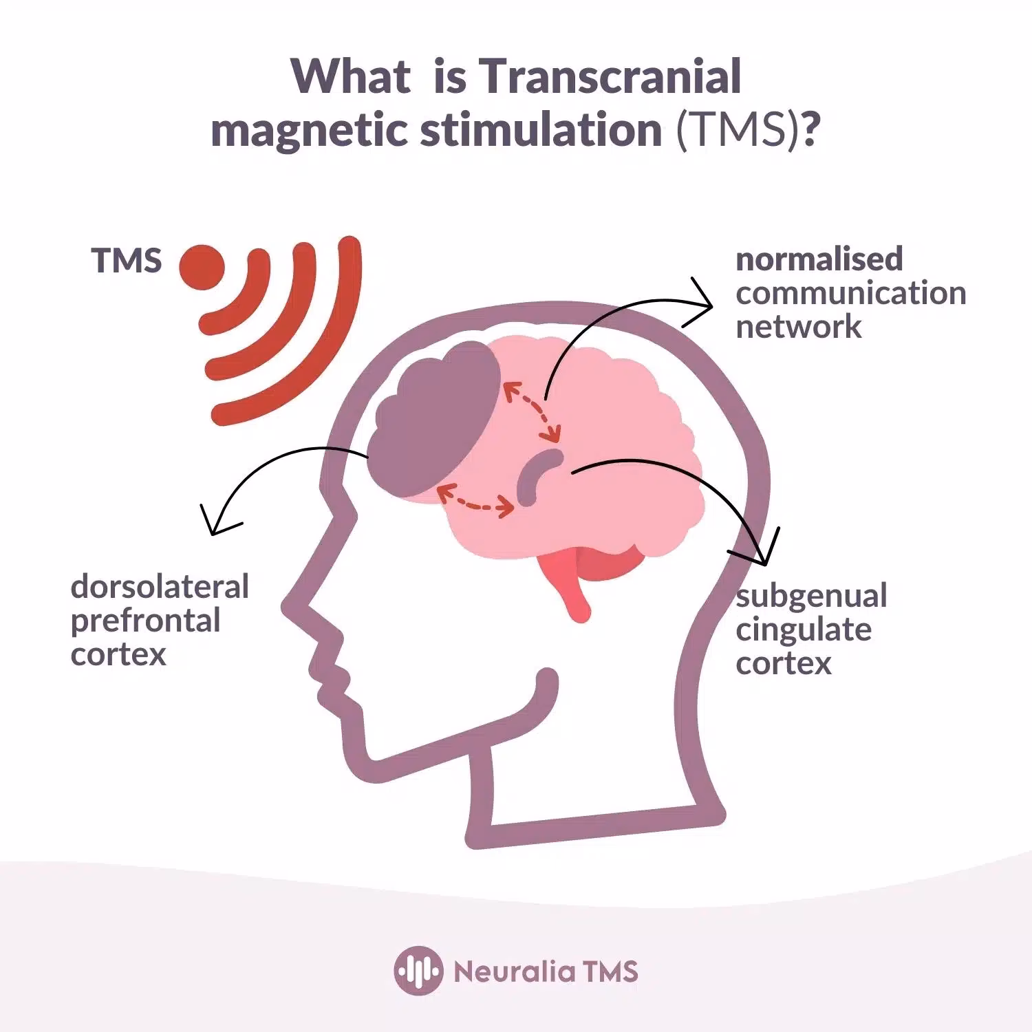 What is TMS in the brain region?